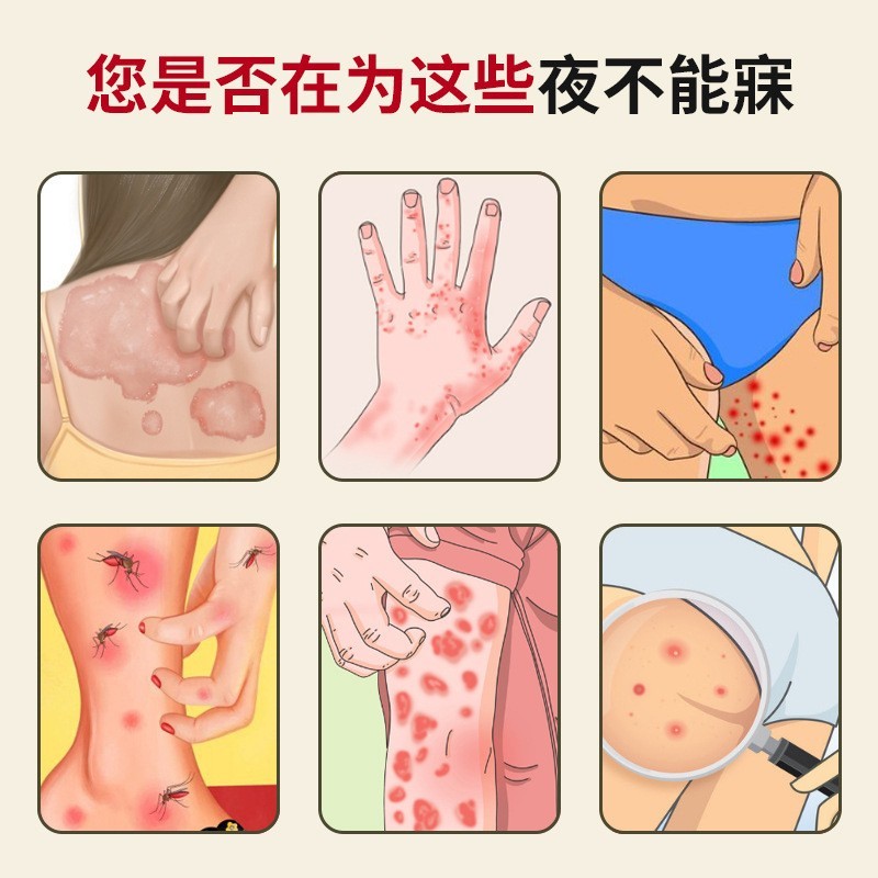 加工定制苗药止痒王抑菌止痒膏瘙痒蚊虫叮咬皮肤止痒软膏图3