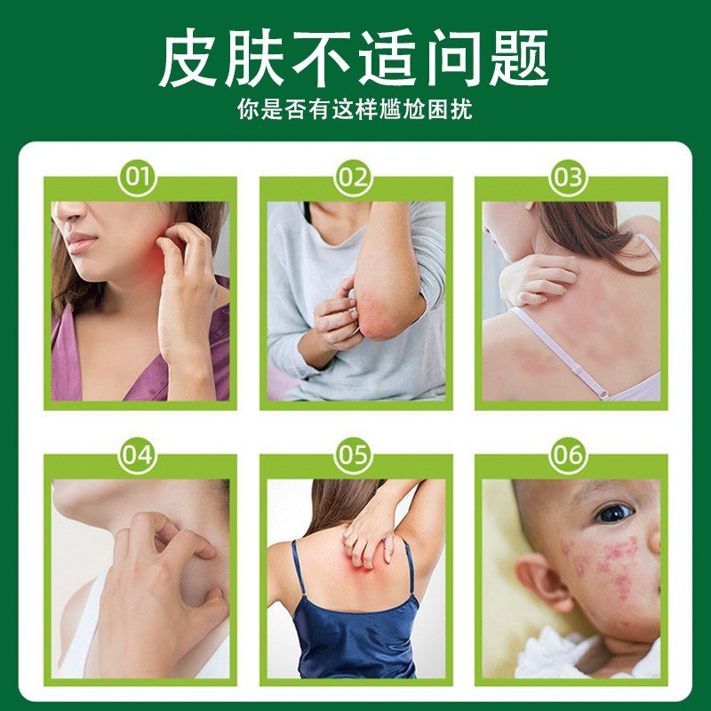 百草真菌王止痒抑菌软膏配方升级效果加强新款OEM代加工厂图2