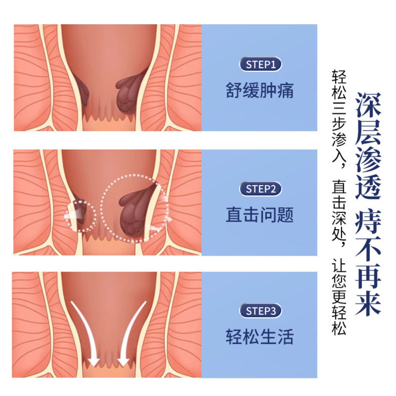 金缕梅膏乳膏槐实膏草本配方通用内外混合肉球痔疮膏OEM代加工厂图2