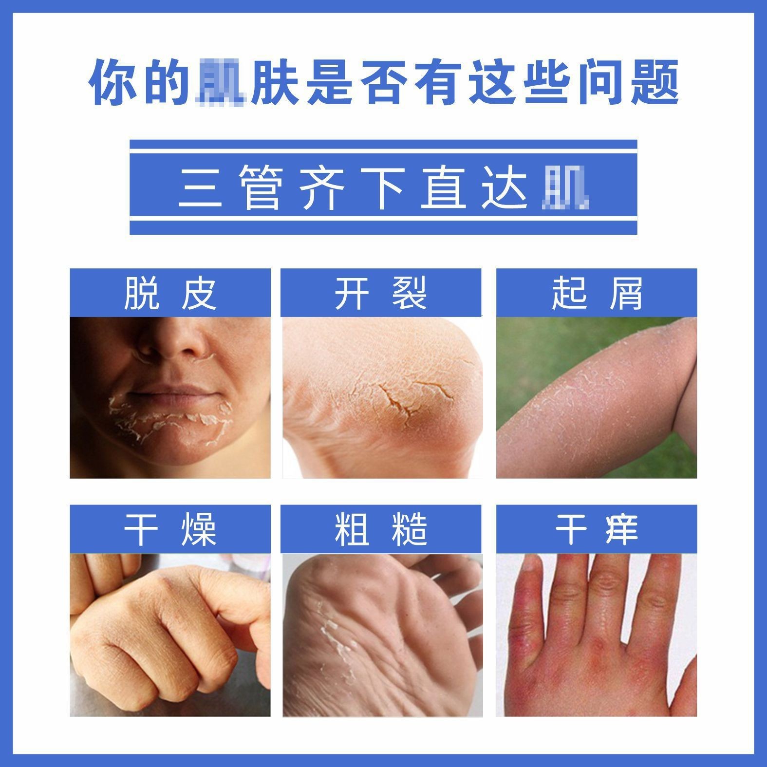 鳄油皴裂膏50g批发冬季防干裂手足皲裂膏通用滋润草本护手霜保健OEM代加工厂图2