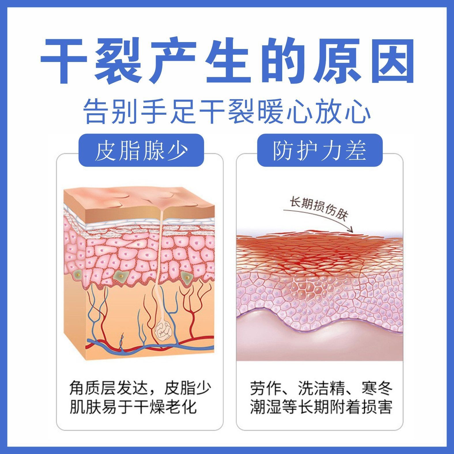 鳄油皴裂膏50g批发冬季防干裂手足皲裂膏通用滋润草本护手霜保健OEM代加工厂图4