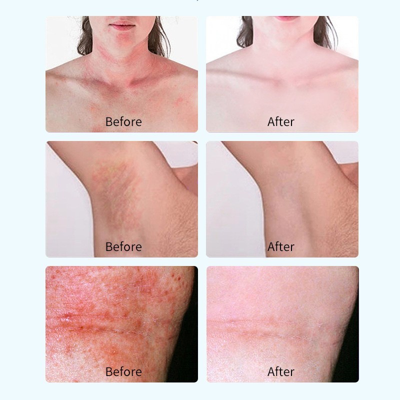 爽身粉瓶装清凉祛痒男女痱子粉清爽舒缓足浴贴牌工厂代工OEM定做 厂家贴牌定制 代工智造图5