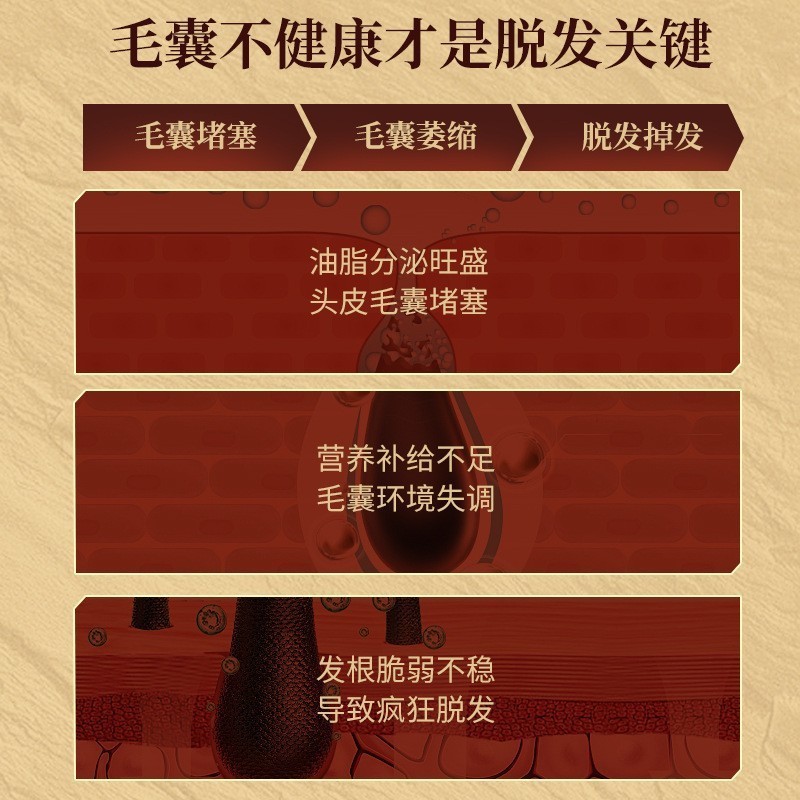 贴牌定制防脱育发洗发水育发养头发防掉防断发固发增发生姜洗发水,代工智造图2