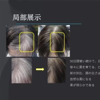 贴牌定制育发液增发液特证防脱发育发液浓密滋养草本育发液头发精华液私域,代工智造