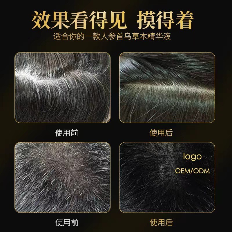 贴牌定制育发液增发液特证防脱发育发液浓密滋养草本育发液头发精华液私域,代工智造图3