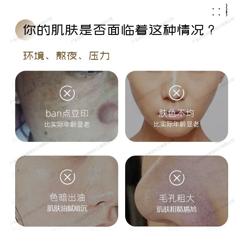 保养液无尴尬期祛班液焕颜液斑后控色防止反黑院线专用调肤液爆款图4