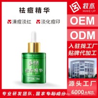 祛痘精华液修复青春痘祛痘印痘坑淡化收缩毛孔院线定制源头厂家