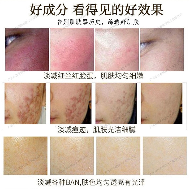 灯炮肌精华素颜精华无尴尬期白透亮美肤液精华亮肤液美容店同爆款图3