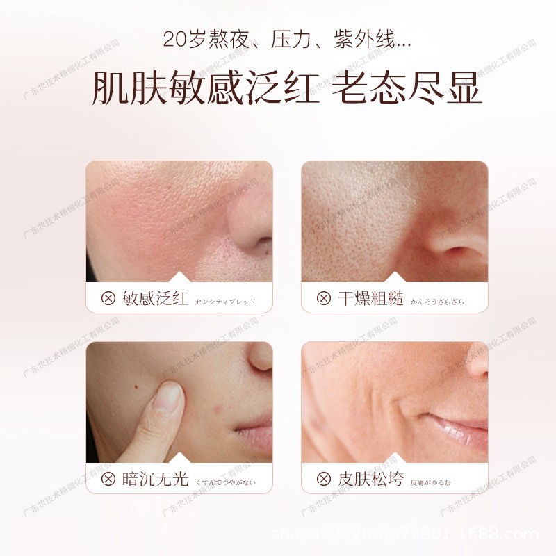 定制OEM源头厂家精华液修复过敏修复屏障增厚角质层激素脸院线品图2