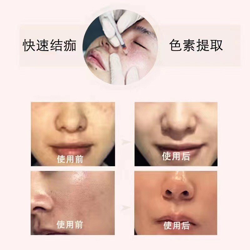 ODM定制祛斑液提取液无尴尬期雀斑老年斑色素分解液调肤液代谢美白滋润图4