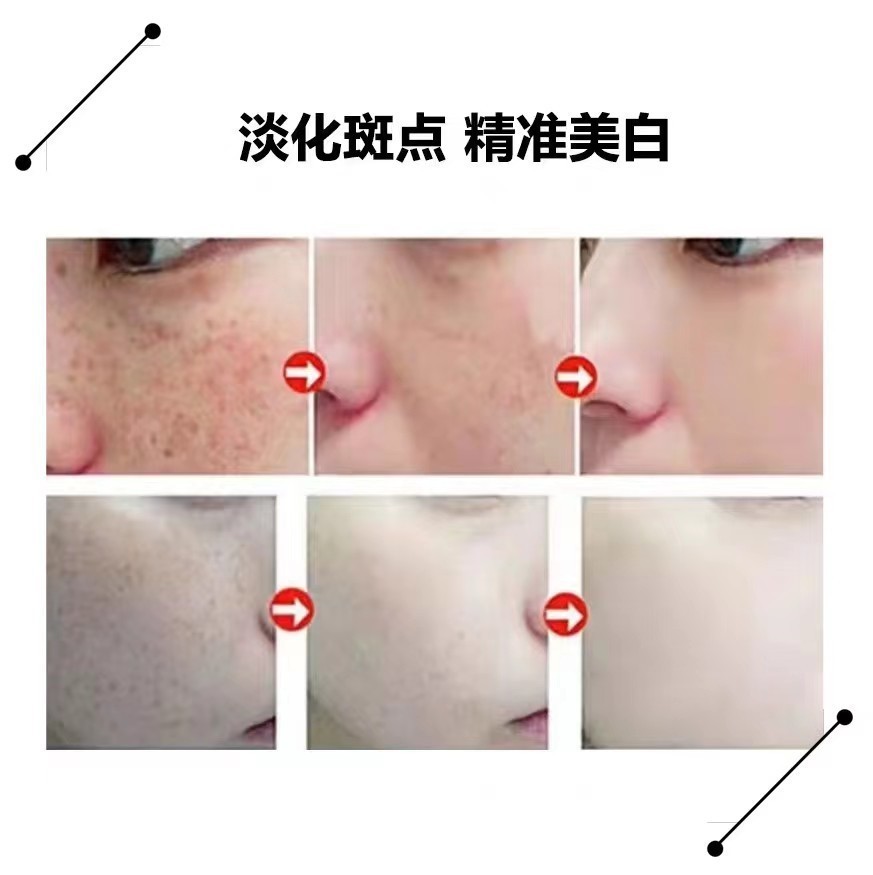 祛斑液排斑液排色液调肤液黄褐斑妊娠斑晒斑无尴尬期美容院专供图3