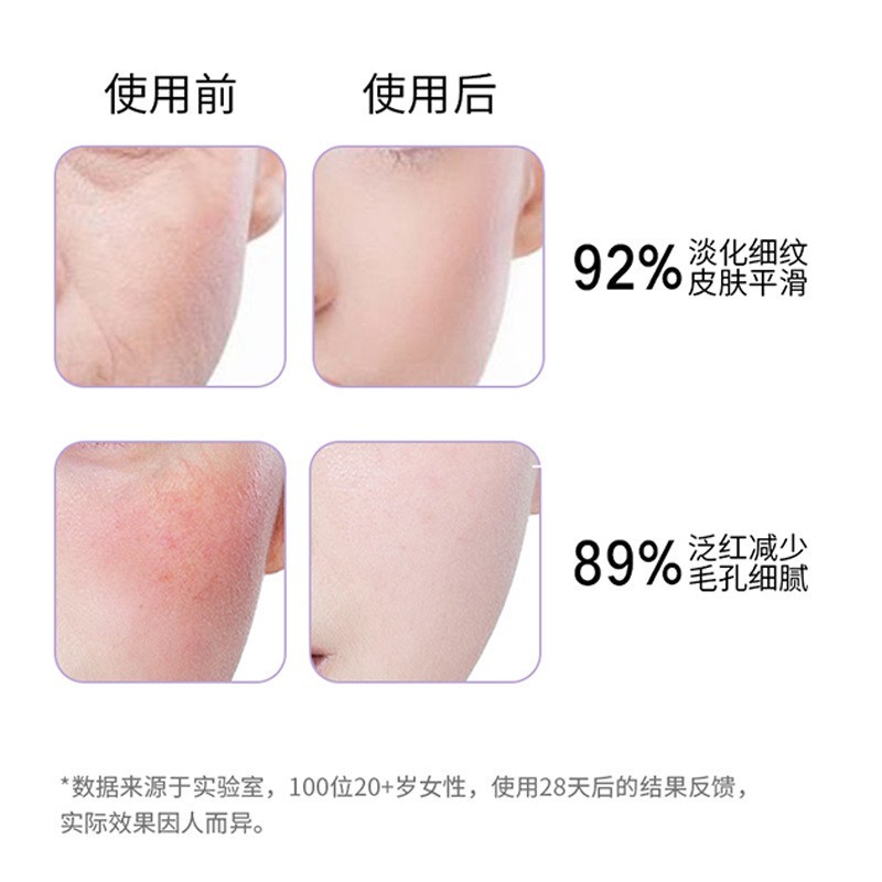 工厂8万活性外泌体冻干粉批发裂裥菌面部寡肽保湿补水裸瓶图3