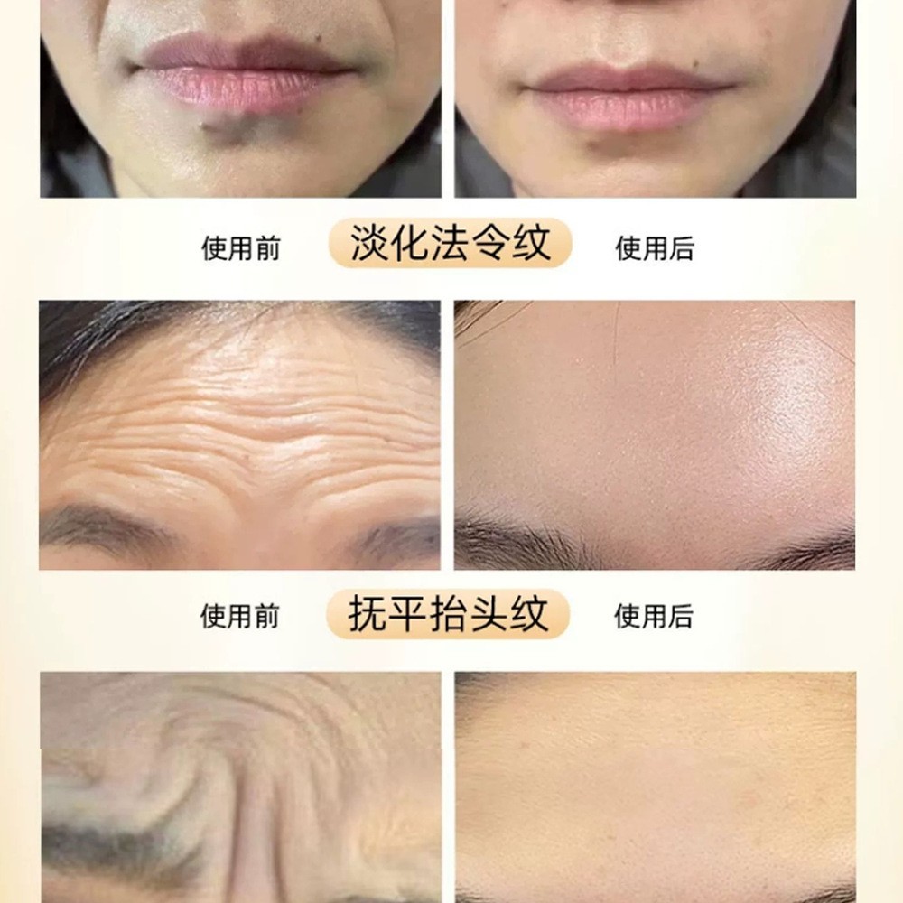 向禾冻干粉紧致抗皱淡化细纹冻干粉加工定制图2