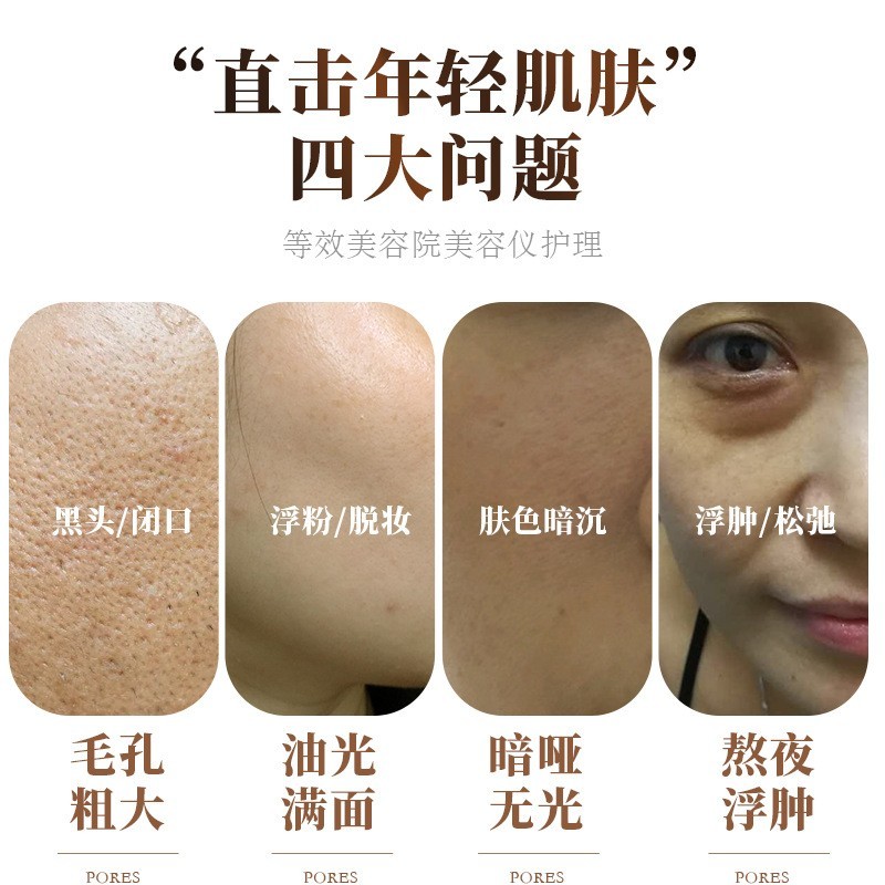 oem超声波美容仪家用脸部提拉电子美容仪器按摩微电流ems导入仪图3