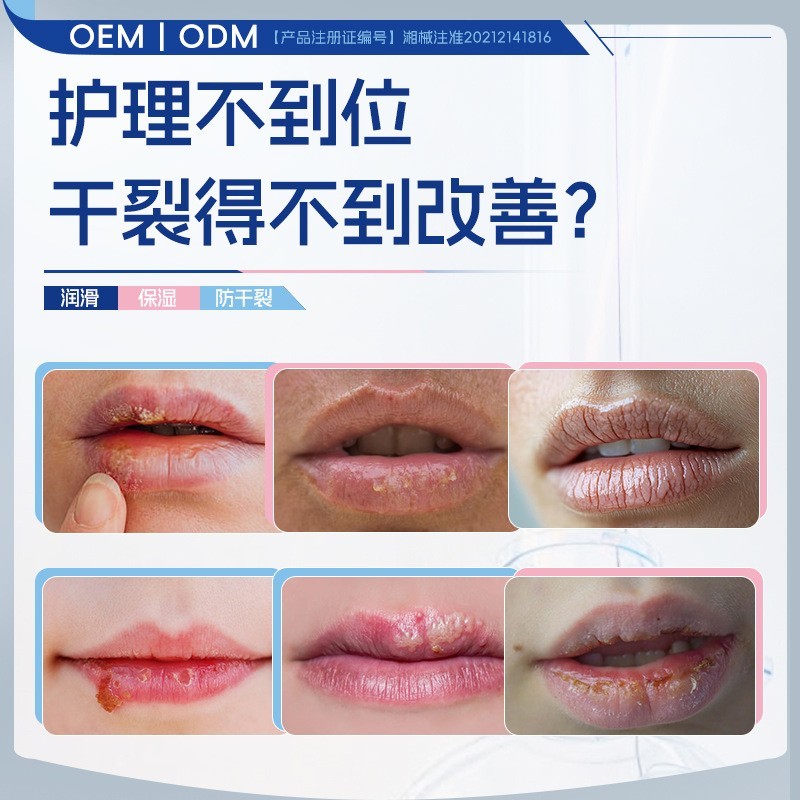 二类医疗器械唇炎膏 医用聚乙二醇润护敷料创面保护保湿防干裂图3