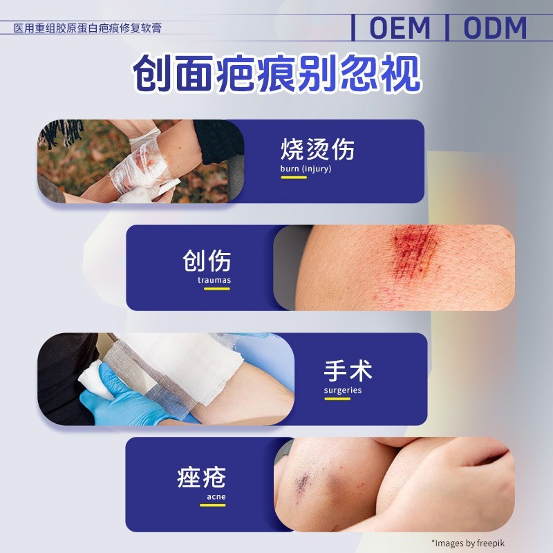 医用重组胶原蛋白疤痕修复凝胶 皮肤修复辅助改善疤痕膏OEM代加工图4