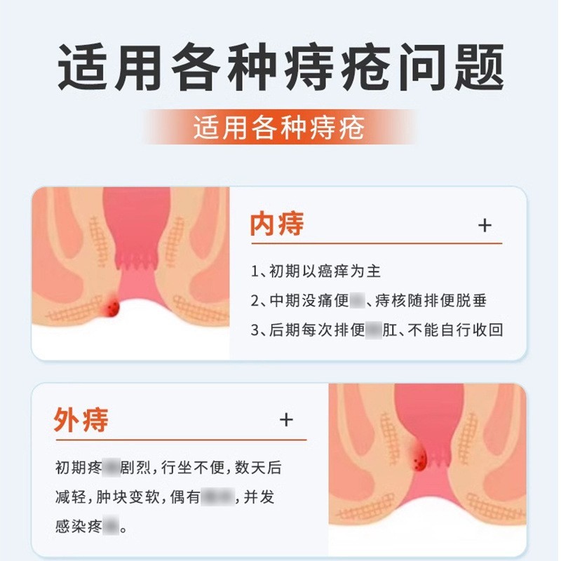 医用痔疮凝胶品牌授权内痔外痔混合痔凝胶辅助治疗oem贴牌代加工图2