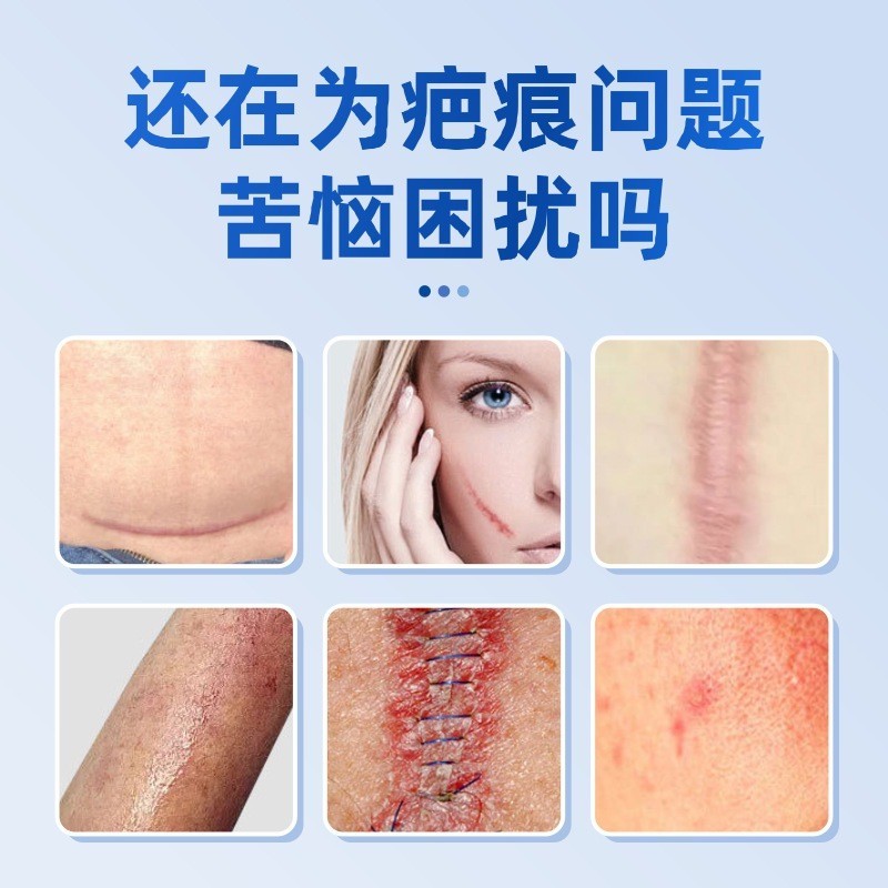 医用硅酮疤痕凝胶定制疤痕冷敷凝胶去疤膏贴牌硅酮去疤膏代加工厂图3