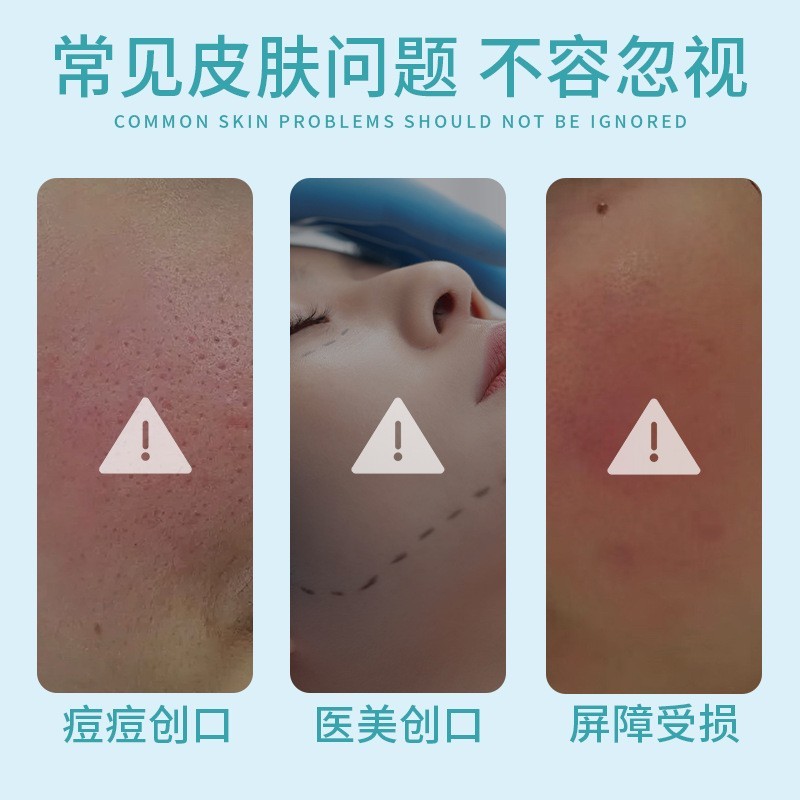 医用透明质酸钠修复贴敷料 械字号冷敷贴医美术后创面修护无菌OEM图4