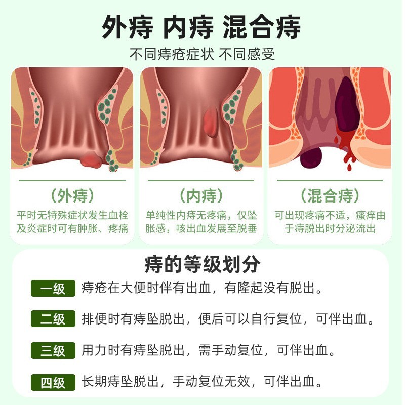 痔疮凝胶定制肛门瘙痒肛部型适用痔疮膏来料加工草本萃取外用凝胶图4