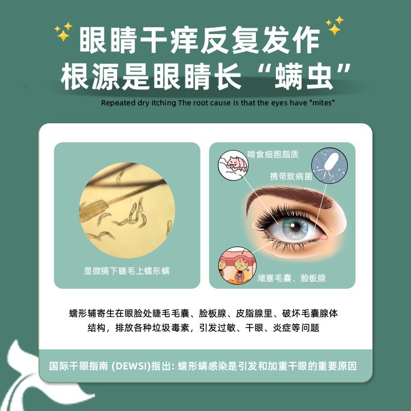 定制一次性4松油醇茶树精油眼睑湿巾眼部护理用眼部除螨清洁湿巾图3