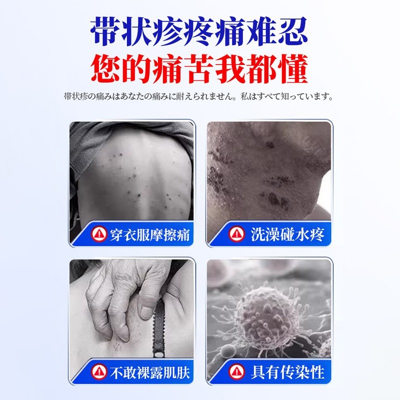 加工定制日本带状孢疹汗疱止痒脱皮水泡疹全身手脚皮肤疙瘩皮痒疼图5