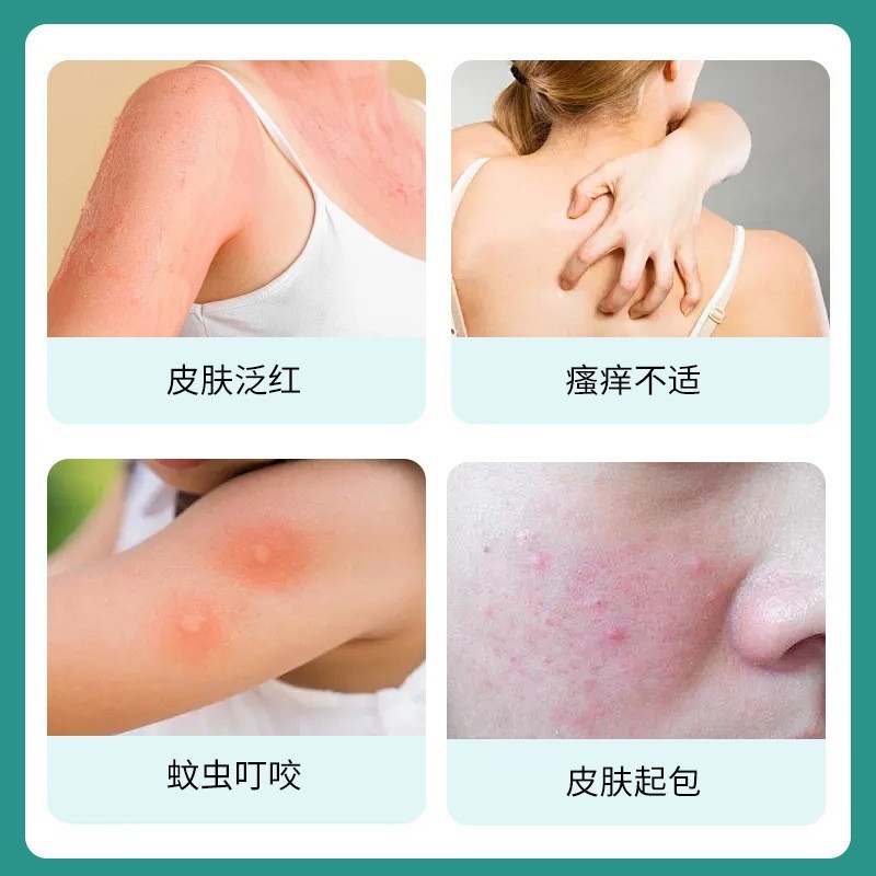 工厂定制百草止痒保健膏蚊虫叮咬身体止痒保健膏皮肤瘙痒外用护理图5