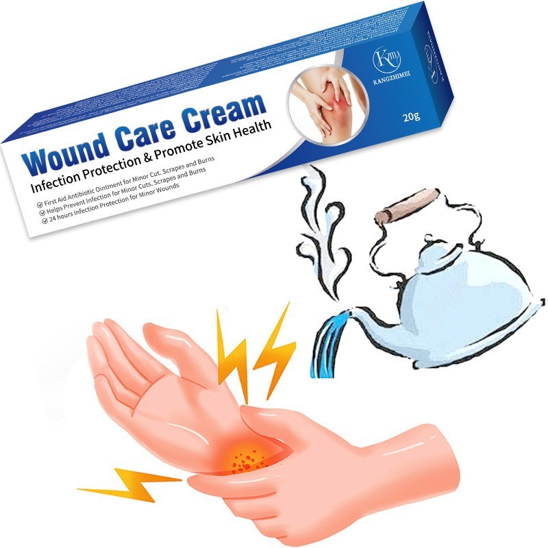 烧烫伤膏跨境开水烫火烫伤膏起泡烫伤外用皮肤乳膏烫伤膏贴牌外贸图2