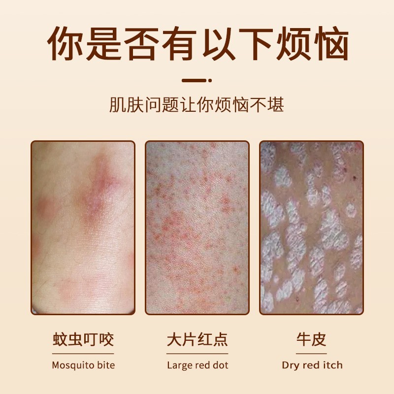 定制皮肤软膏外用涂抹乳膏代加工皮肤骚痒藓痒螨虫百草抑菌膏贴牌图5