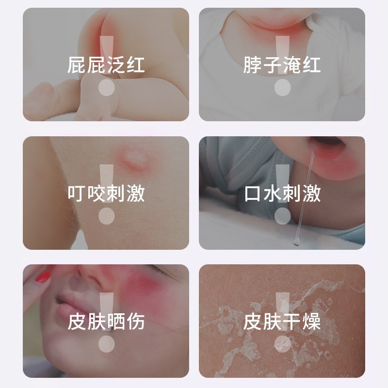 背粒消OEM通用喷雾背部喷雾厂家批发代发背部痘痘喷雾代加工图2