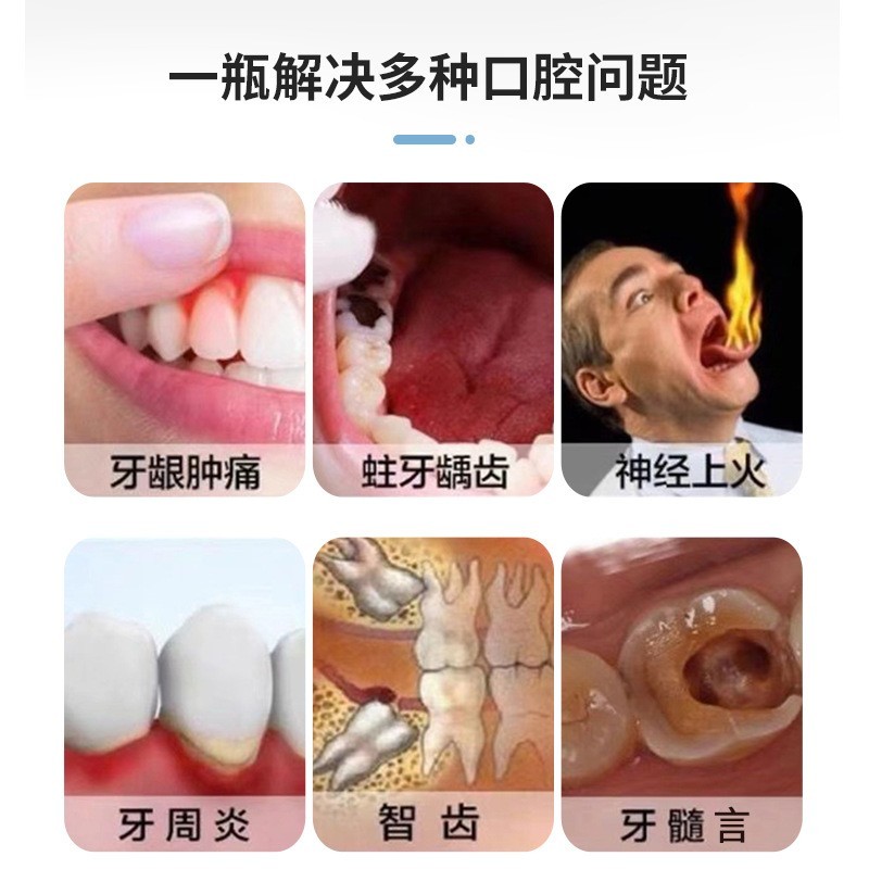 定制贴牌牙痛宁喷剂 蛀牙虫牙疼水口腔护理草本抑菌液OEM代加工图3