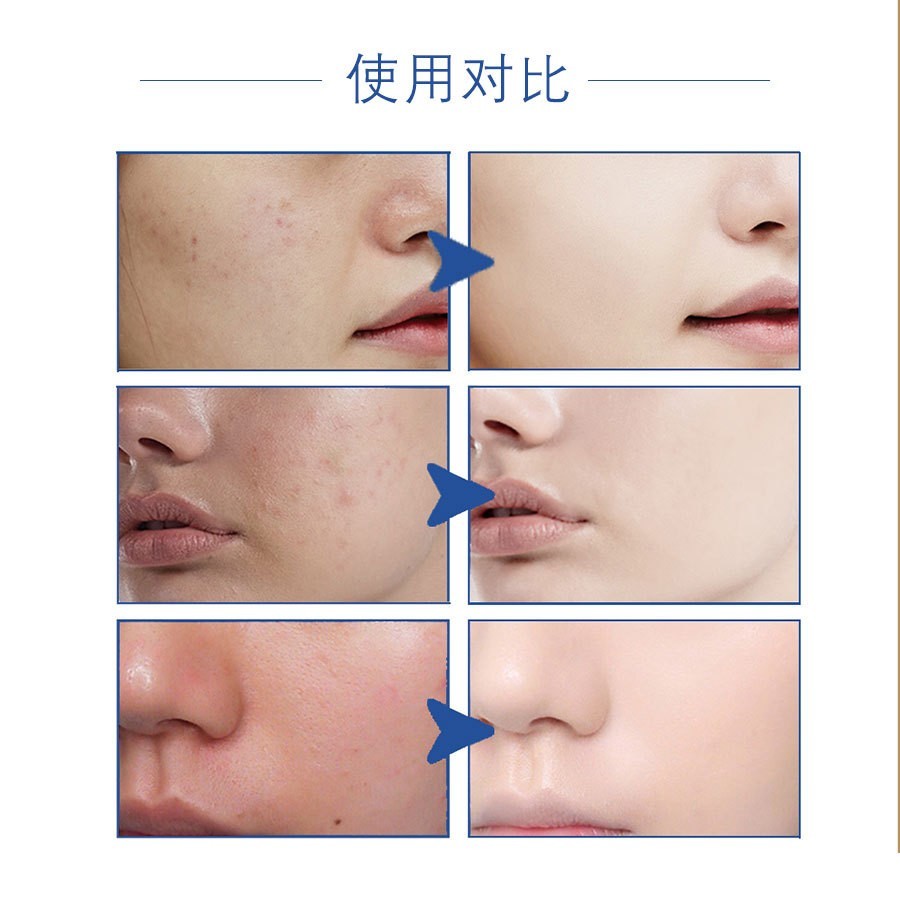 多重玻尿酸精华液小分子透明质酸补水保湿嫩肤修护面部护肤品原液图3