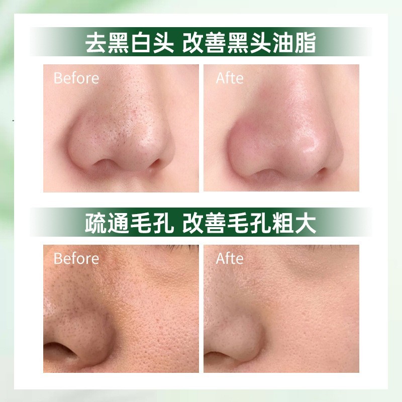 黑头导出精华液温和不刺激深度清洁控油细致收缩毛孔OEM精华液图2
