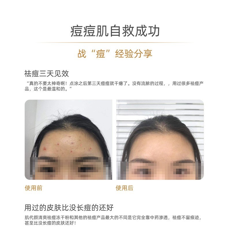 祛红血丝寡肽亮肤修护冻干粉美容院定制修复屏障祛痘印修复图2