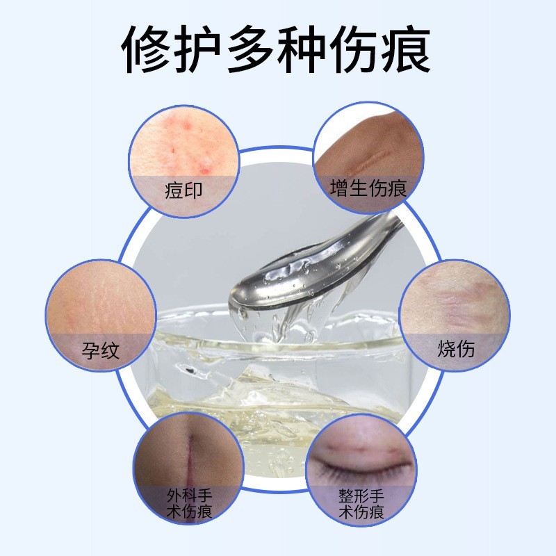 贴牌加工院线多肽破皮修护退红冰晶淡化痘疤印槲皮素光子冷敷凝胶图2