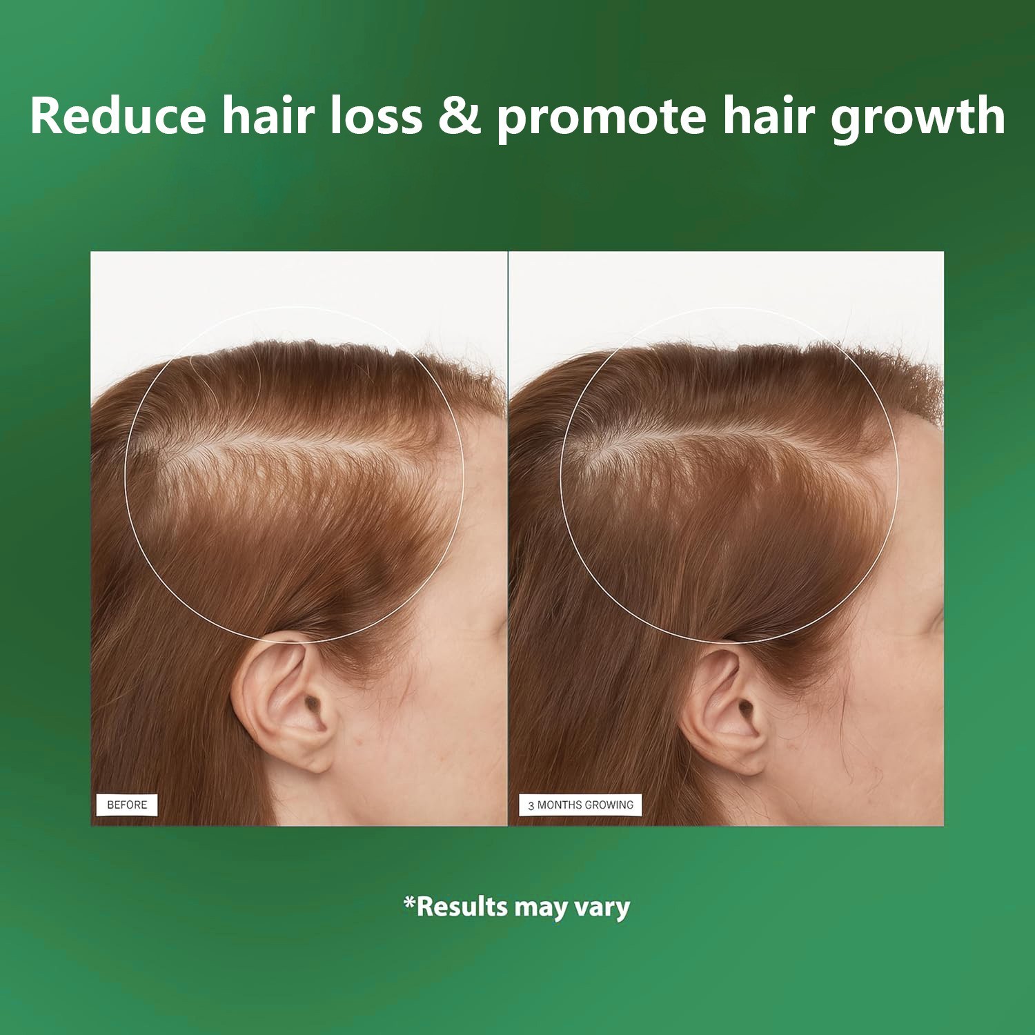 跨境迷迭香精华滚珠头发生液头皮护理营养液迷迭香精油定制贴牌图2