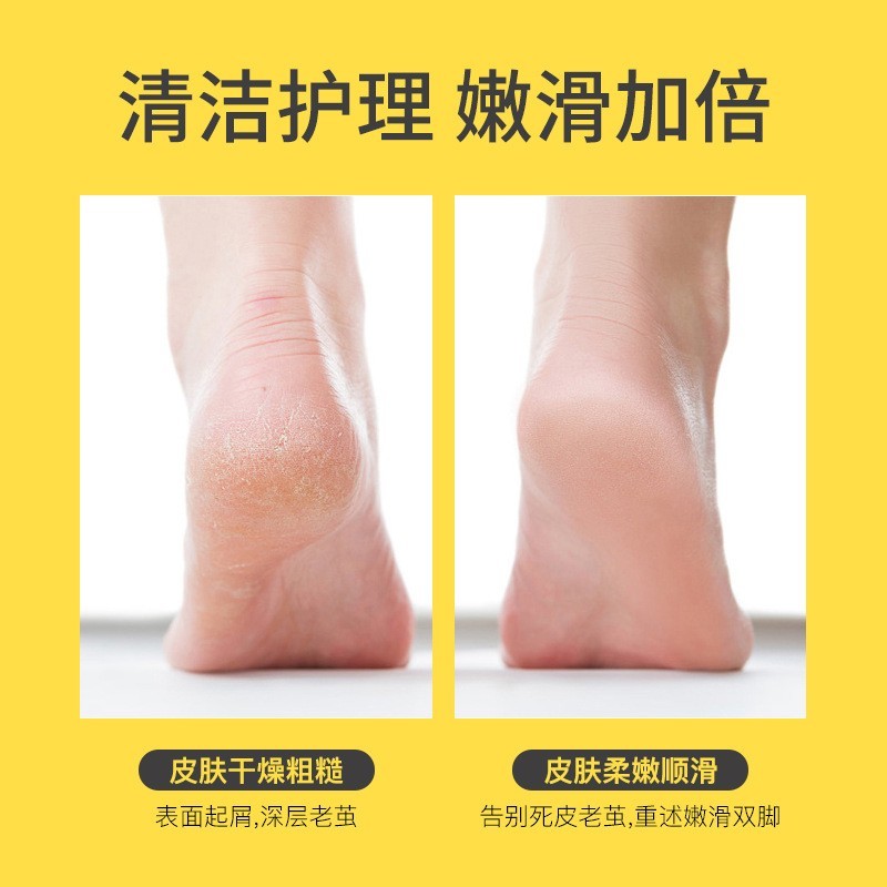 新款电动磨脚器去死皮修脚神器老茧去脚皮防水吸尘修脚器图2