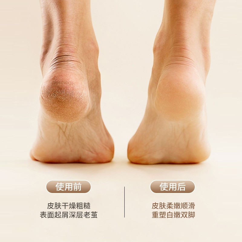 跨境电动磨脚器皮自动充电式去脚皮死皮磨老茧刀修脚器图3