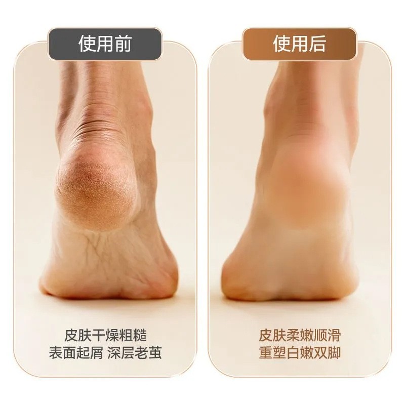 电动磨脚器去死皮老茧液晶显示修脚器磨脚石脚后跟家用搓脚皮神器图3