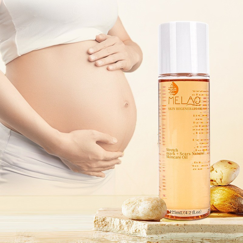 跨境产后修护油孕妇妊娠淡化腹部肚子纹橘子皮产前护理身体按摩油图5