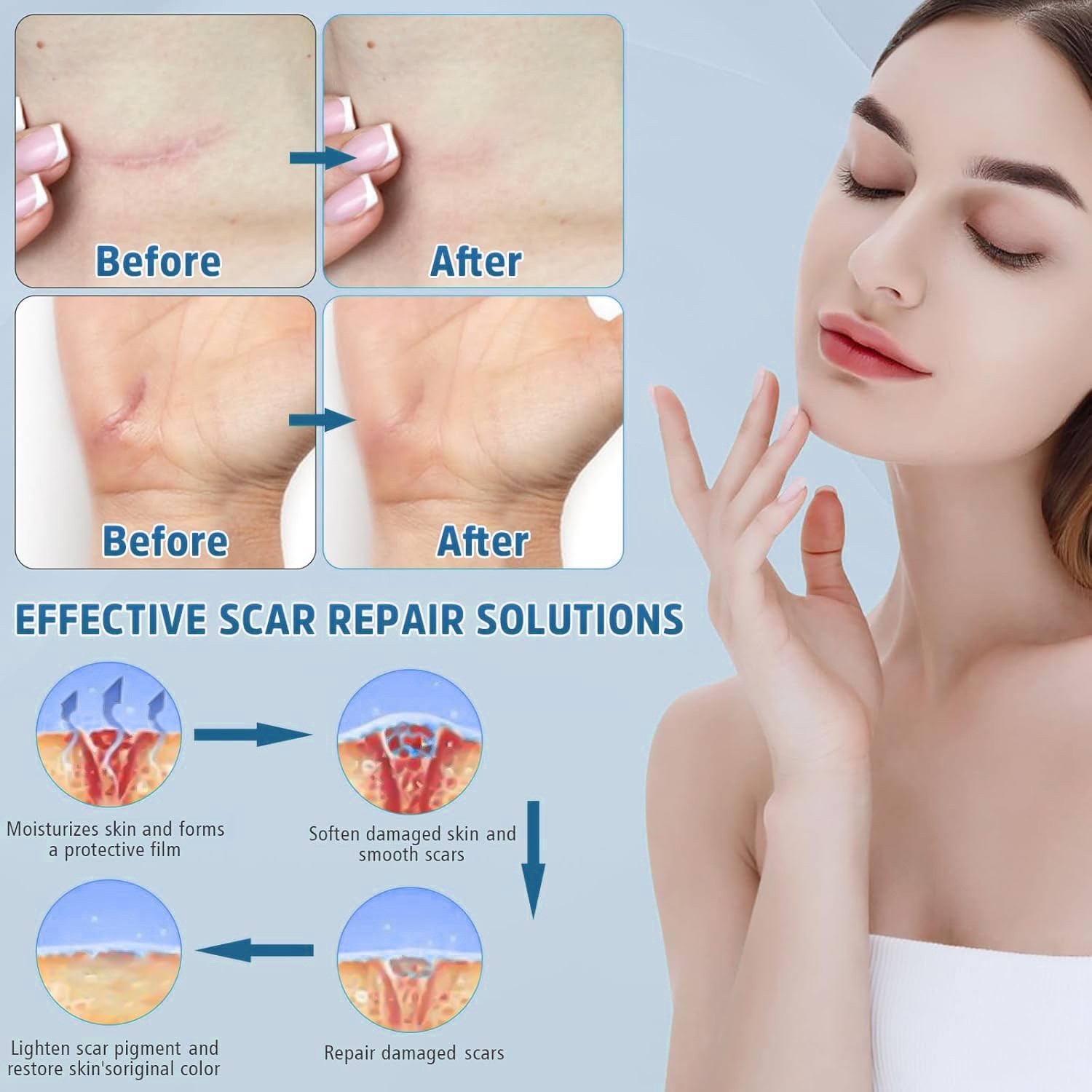 跨境硅胶疤痕霜滋润修护淡化均匀肤色妊娠纹紧致皮肤护理膏贴牌图2