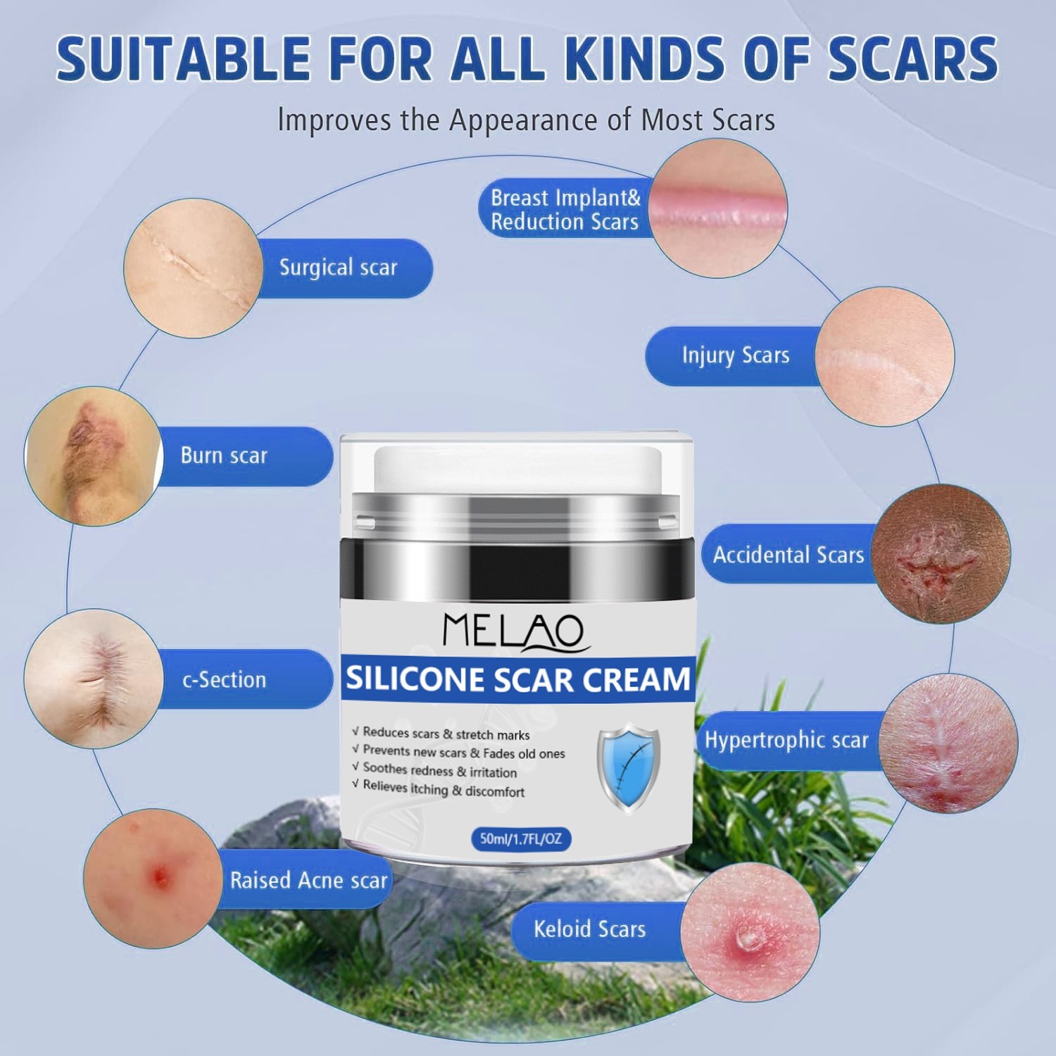 跨境硅胶疤痕霜滋润修护淡化均匀肤色妊娠纹紧致皮肤护理膏贴牌图4