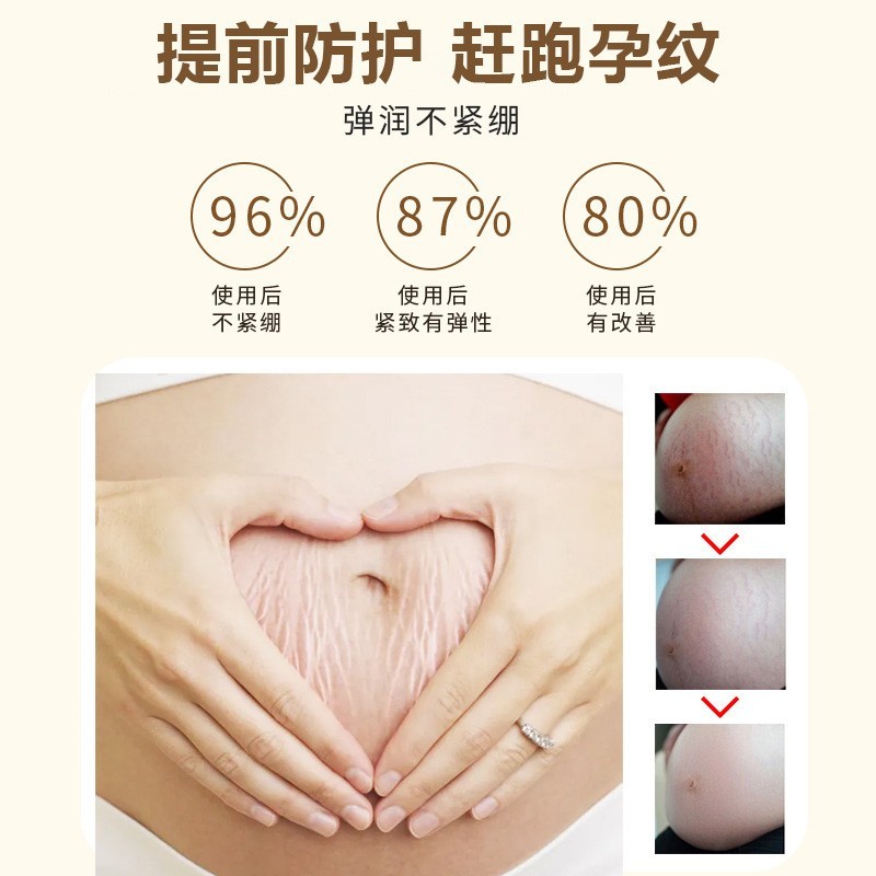 跨境产后修护霜 弹润保湿妈咪孕纹肚子纹橘子皮身体护理膏孕妇霜图3