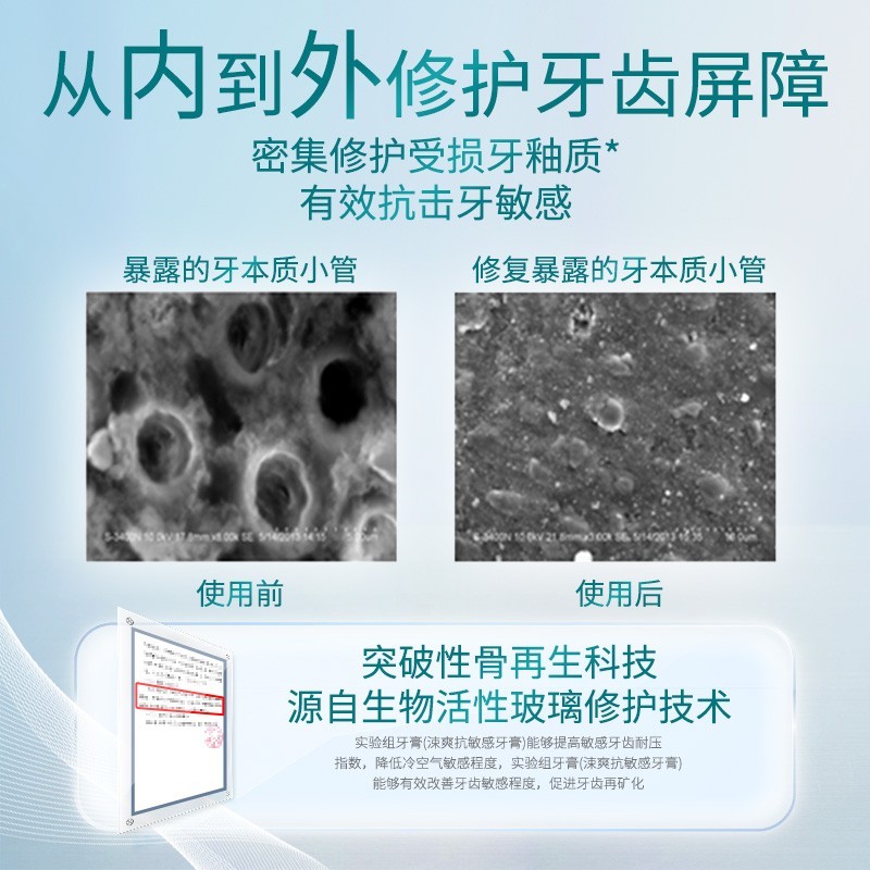 涑爽抗敏感牙膏脱敏孕妇牙周护理舒缓牙龈口腔生物活性玻璃图2