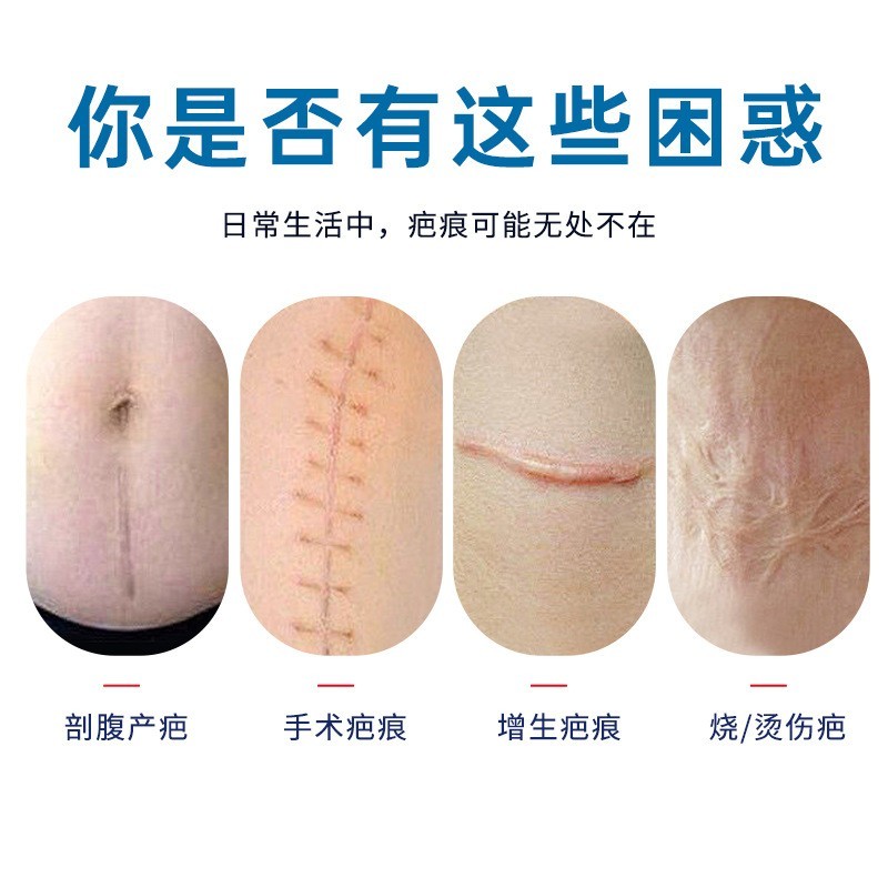 贴牌硅酮疤痕凝胶疤痕膏产后术后烧伤疤痕淡化修复去新旧疤膏祛疤图2