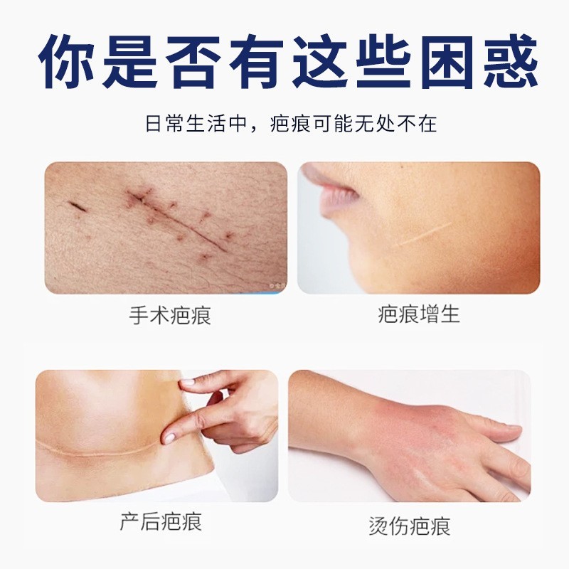 医用疤痕修复液烧烫伤手术产后病理性疤痕修复液体敷料源头工厂图3