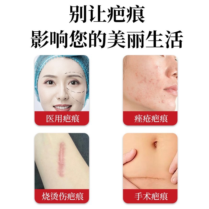 贴牌定制医用疤痕修复凝胶手术创伤产后病理性疤痕消除修复凝胶图3