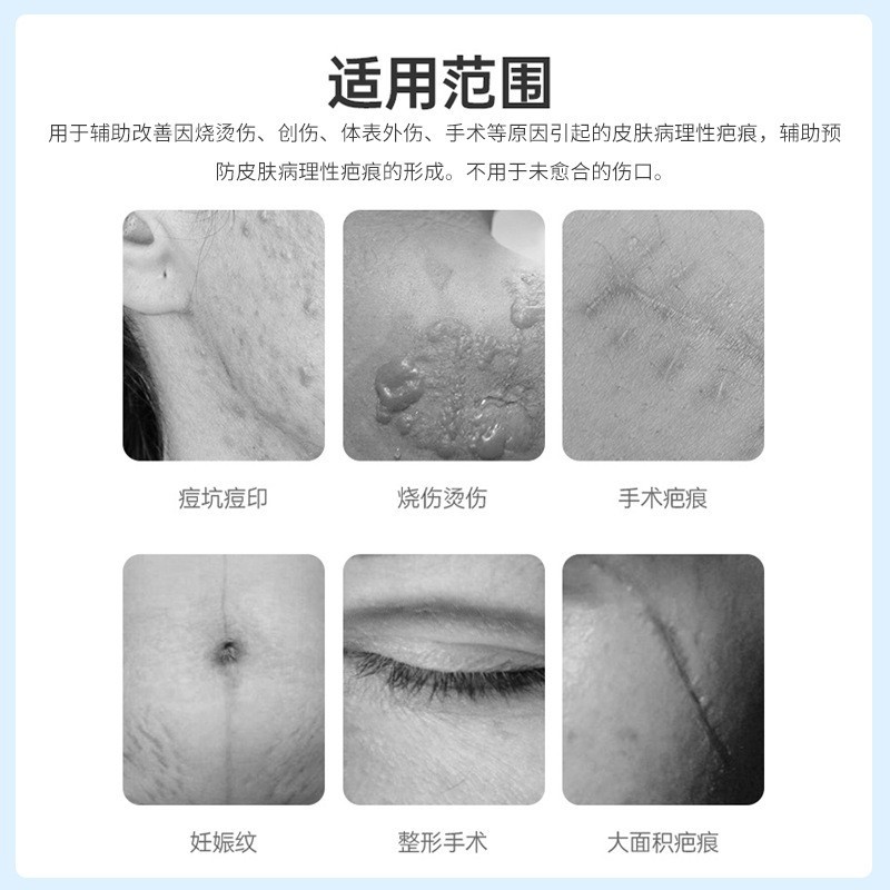 定制医用硅酮疤痕凝胶烧伤烫伤医美术后产后增生疤痕修复疤痕膏图3