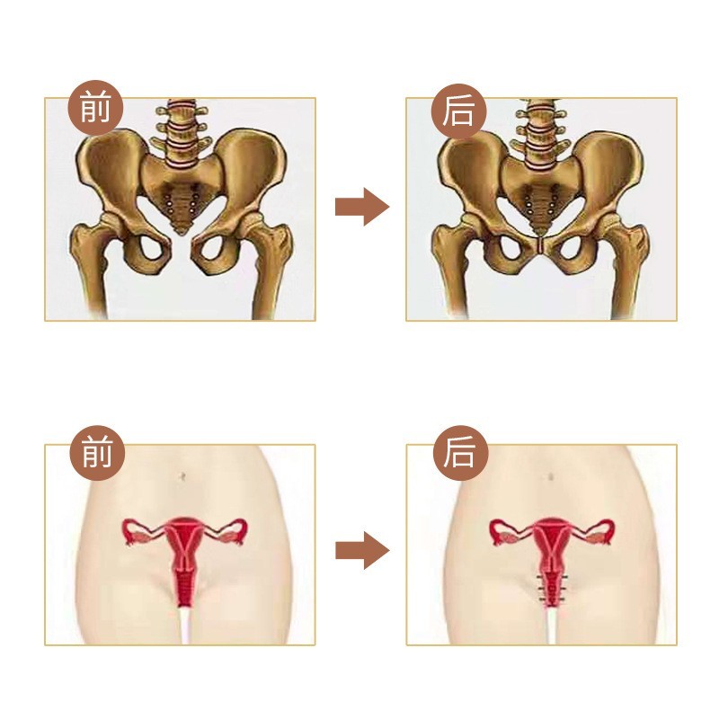 定制盆骨闭合胶囊美容院女性产后护理修护盆底肌盆骨私处胶囊贴牌图2
